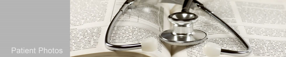 Newport Skin Cancer - Patient Photos